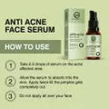 Anti-Acne Serum - Pimple & Oil Control (30ml)