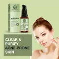 Anti-Acne Serum - Pimple & Oil Control (30ml)
