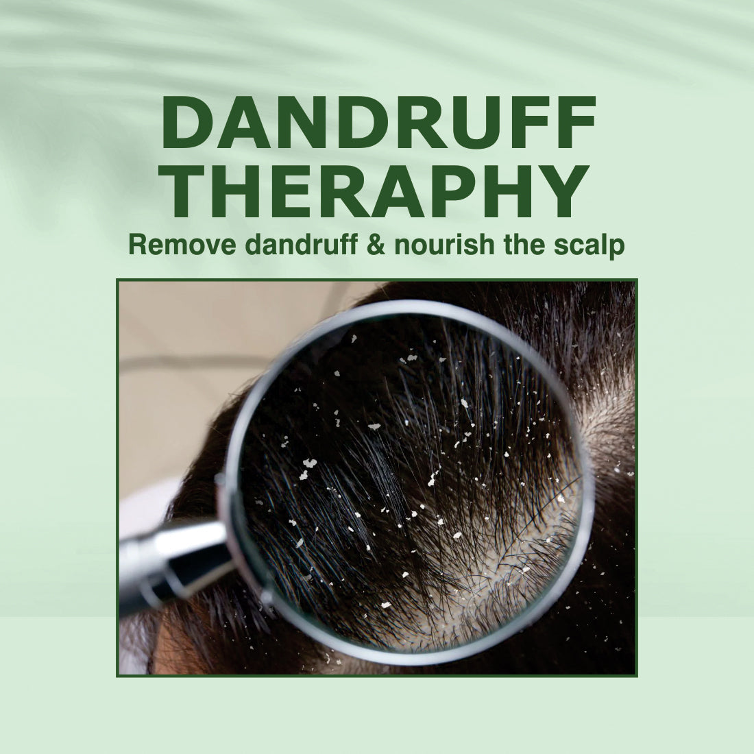 Anti-Dandruff Oil | Rejuvenate Your Scalp, Rediscover Confidence - 100ml