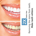 Activated Charcoal Teeth Whitening Powder with Coconut Shell - 100gm