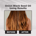 Onion Black Seed Hair Oil - 200ml
