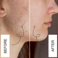 Kumkumadi Face Oil For Glowing Face - 15ml