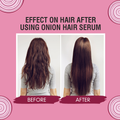 Onion Hair Serum with Jaborandi Oil - 100ml